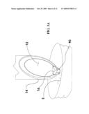 OPTICAL SAFETY TROCAR AND METHOD OF USE THEREOF diagram and image