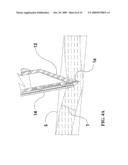 OPTICAL SAFETY TROCAR AND METHOD OF USE THEREOF diagram and image