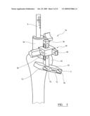 VARIABLE OFFSET REAMER ASSEMBLY FOR MODULAR HUMERAL COMPONENT diagram and image