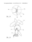 VARIABLE OFFSET REAMER ASSEMBLY FOR MODULAR HUMERAL COMPONENT diagram and image