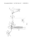 REMOTELY-ACTIVATED VERTEBROPLASTY INJECTION DEVICE diagram and image