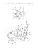 REMOTELY-ACTIVATED VERTEBROPLASTY INJECTION DEVICE diagram and image