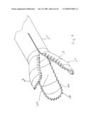 STEERABLE MEDICAL DEVICE FOR TISSUE DISRUPTION diagram and image