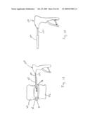 STEERABLE MEDICAL DEVICE FOR TISSUE DISRUPTION diagram and image