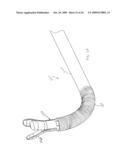 STEERABLE MEDICAL DEVICE FOR TISSUE DISRUPTION diagram and image