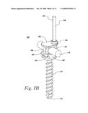 IMPLANTS FOR SECURING SPINAL FIXATION ELEMENTS diagram and image