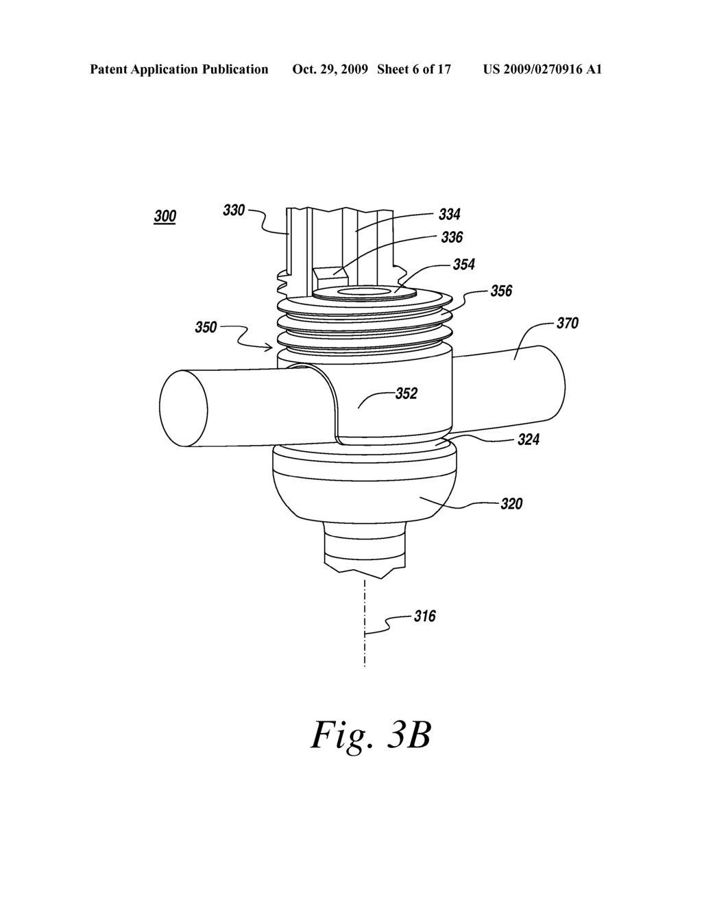 IMPLANTS FOR SECURING SPINAL FIXATION ELEMENTS - diagram, schematic, and image 07