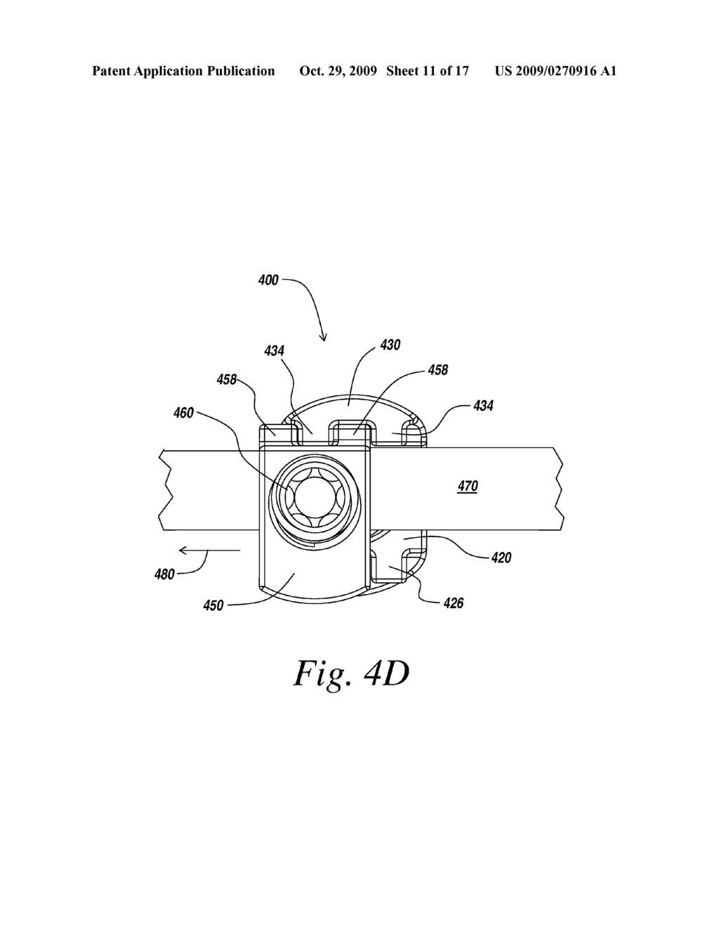 IMPLANTS FOR SECURING SPINAL FIXATION ELEMENTS - diagram, schematic, and image 12