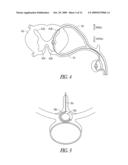 SYSTEMS AND METHODS FOR DELIVERING ELECTRIC CURRENT FOR SPINAL CORD STIMULATION diagram and image