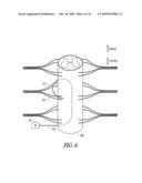 SYSTEMS AND METHODS FOR DELIVERING ELECTRIC CURRENT FOR SPINAL CORD STIMULATION diagram and image