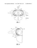 SYSTEMS AND METHODS FOR DELIVERING ELECTRIC CURRENT FOR SPINAL CORD STIMULATION diagram and image