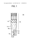 STENT ATTACHMENT AND DEPLOYMENT MECHANISM diagram and image