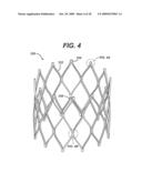 STENT ATTACHMENT AND DEPLOYMENT MECHANISM diagram and image