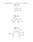 STENT ATTACHMENT AND DEPLOYMENT MECHANISM diagram and image