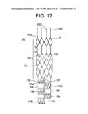 STENT ATTACHMENT AND DEPLOYMENT MECHANISM diagram and image