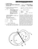 Methods and Devices for Improving Mitral Valve Function diagram and image