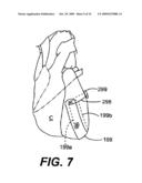 Methods and Devices for Improving Mitral Valve Function diagram and image