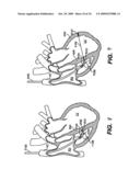 Methods and Devices for Improving Mitral Valve Function diagram and image