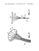 Methods and Devices for Improving Mitral Valve Function diagram and image