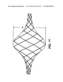 Methods and Devices for Improving Mitral Valve Function diagram and image