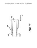 Methods and Devices for Improving Mitral Valve Function diagram and image