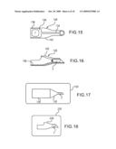 DEVICE TO STORE AND INJECT CORNEAL GRAFT diagram and image