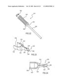 DEVICE TO STORE AND INJECT CORNEAL GRAFT diagram and image