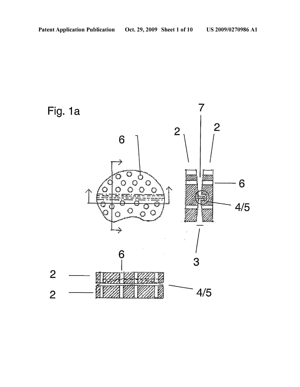 Disc Implant - diagram, schematic, and image 02