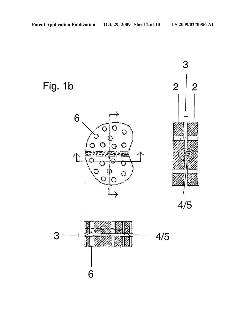 Disc Implant - diagram, schematic, and image 03