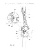 ORIENTATION FEATURE ON ECCENTRIC GLENOSPHERE diagram and image