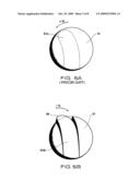 Medial and lateral femoral implants for single-compartment knee prosthesis diagram and image