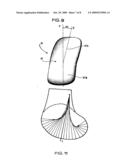 Medial and lateral femoral implants for single-compartment knee prosthesis diagram and image