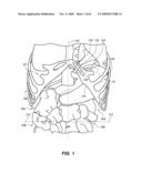 MINIMALLY-INVASIVE METHODS FOR IMPLANTING OBESITY TREATMENT DEVICES diagram and image