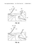 MINIMALLY-INVASIVE METHODS FOR IMPLANTING OBESITY TREATMENT DEVICES diagram and image