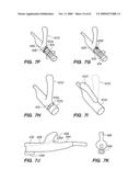 MINIMALLY-INVASIVE METHODS FOR IMPLANTING OBESITY TREATMENT DEVICES diagram and image