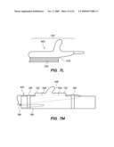 MINIMALLY-INVASIVE METHODS FOR IMPLANTING OBESITY TREATMENT DEVICES diagram and image