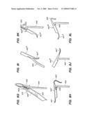 MINIMALLY-INVASIVE METHODS FOR IMPLANTING OBESITY TREATMENT DEVICES diagram and image