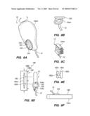 MINIMALLY-INVASIVE METHODS FOR IMPLANTING OBESITY TREATMENT DEVICES diagram and image