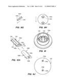 MINIMALLY-INVASIVE METHODS FOR IMPLANTING OBESITY TREATMENT DEVICES diagram and image