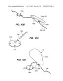 MINIMALLY-INVASIVE METHODS FOR IMPLANTING OBESITY TREATMENT DEVICES diagram and image