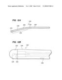 MINIMALLY-INVASIVE METHODS FOR IMPLANTING OBESITY TREATMENT DEVICES diagram and image