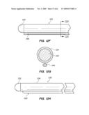 MINIMALLY-INVASIVE METHODS FOR IMPLANTING OBESITY TREATMENT DEVICES diagram and image