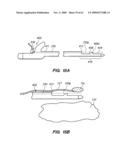 MINIMALLY-INVASIVE METHODS FOR IMPLANTING OBESITY TREATMENT DEVICES diagram and image