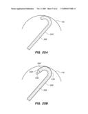 MINIMALLY-INVASIVE METHODS FOR IMPLANTING OBESITY TREATMENT DEVICES diagram and image