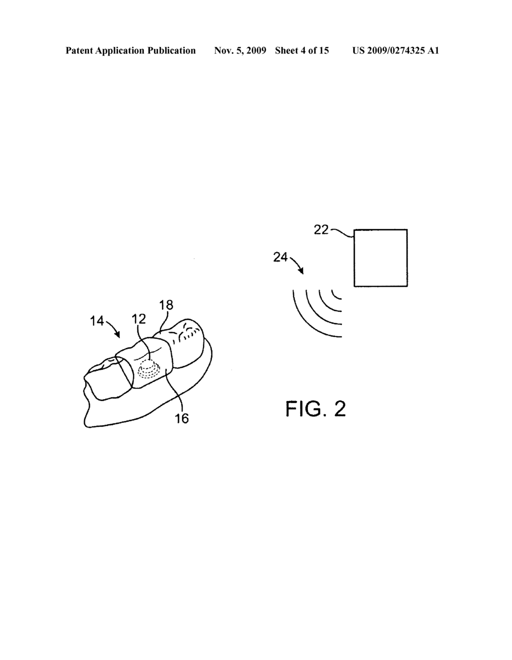 METHODS AND APPARATUS FOR TRANSMITTING VIBRATIONS - diagram, schematic, and image 05