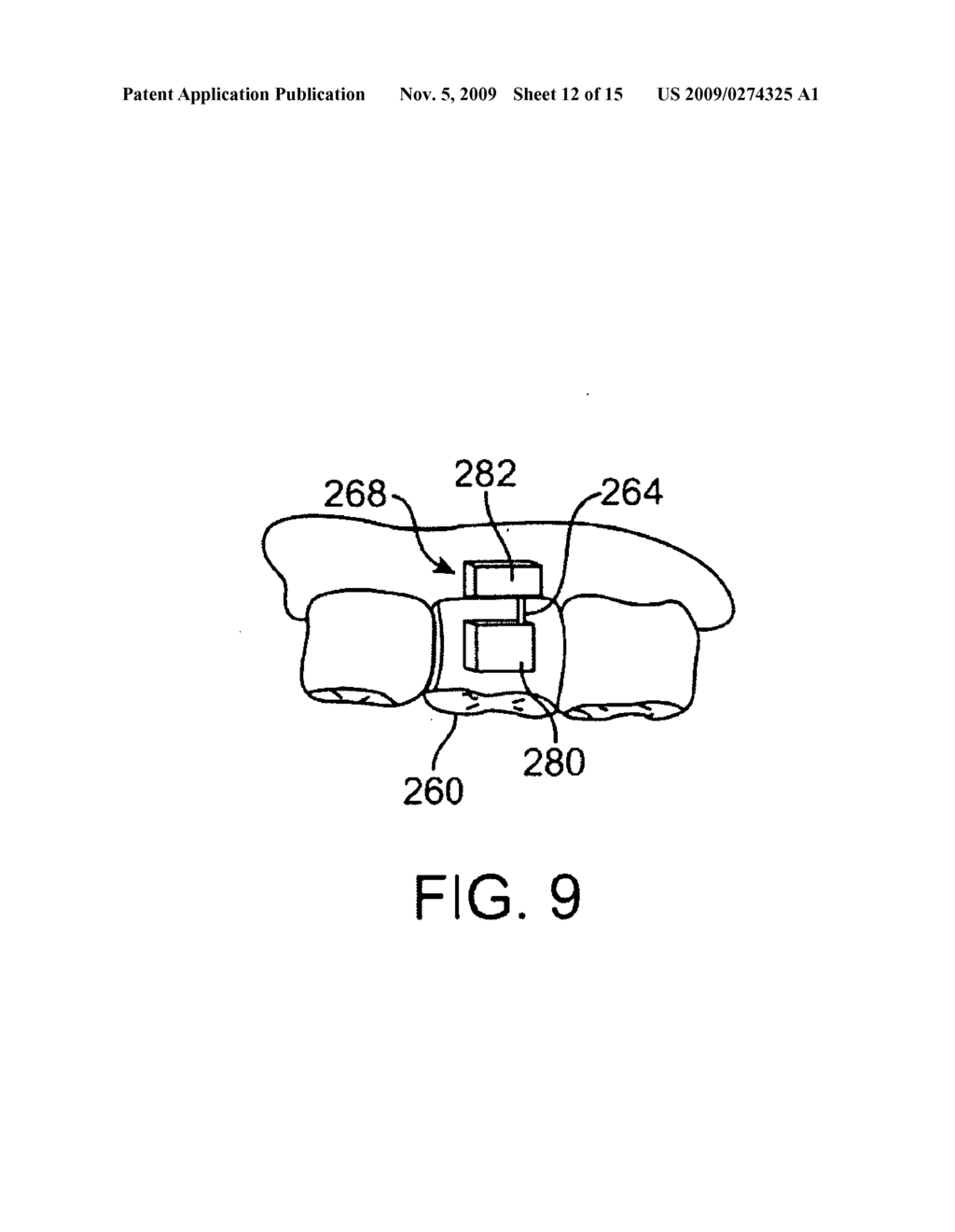 METHODS AND APPARATUS FOR TRANSMITTING VIBRATIONS - diagram, schematic, and image 13