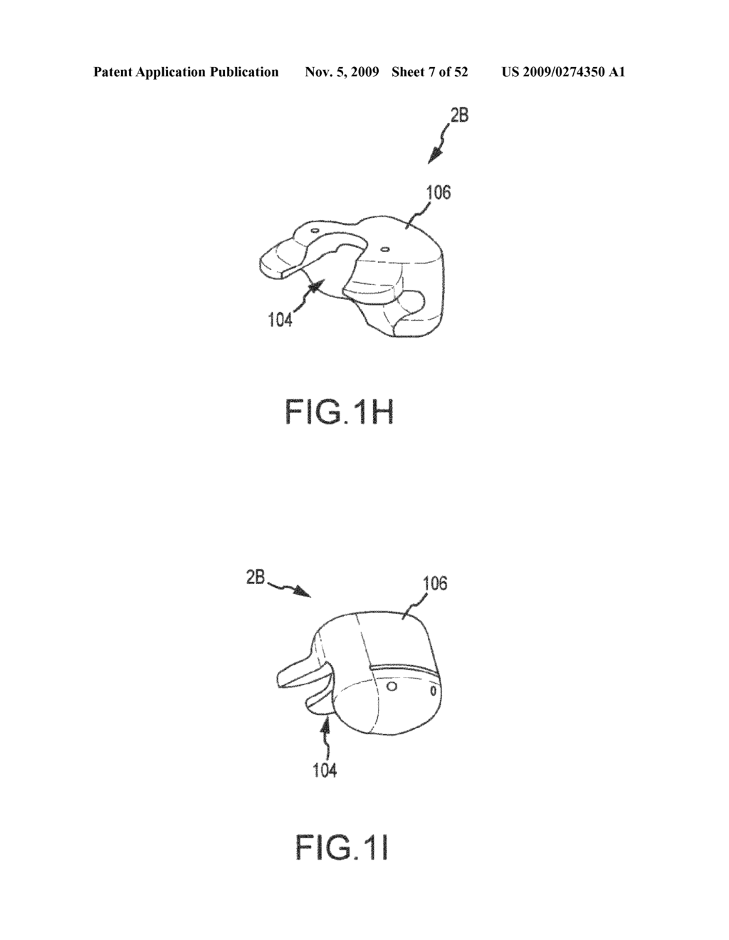 System and method for image segmentation in generating computer models of a joint to undergo arthroplasty - diagram, schematic, and image 08