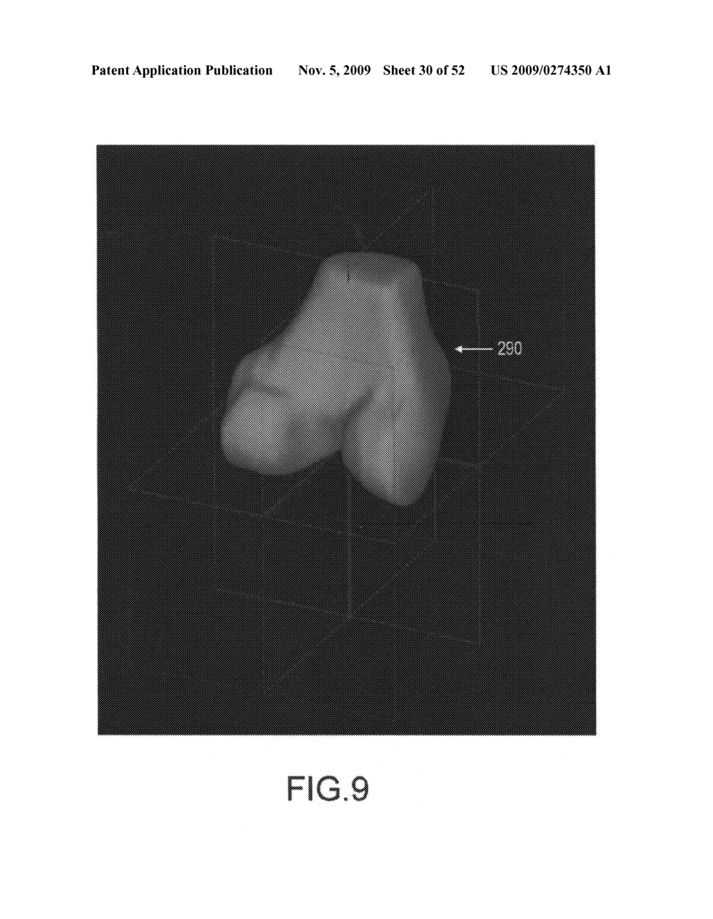 System and method for image segmentation in generating computer models of a joint to undergo arthroplasty - diagram, schematic, and image 31