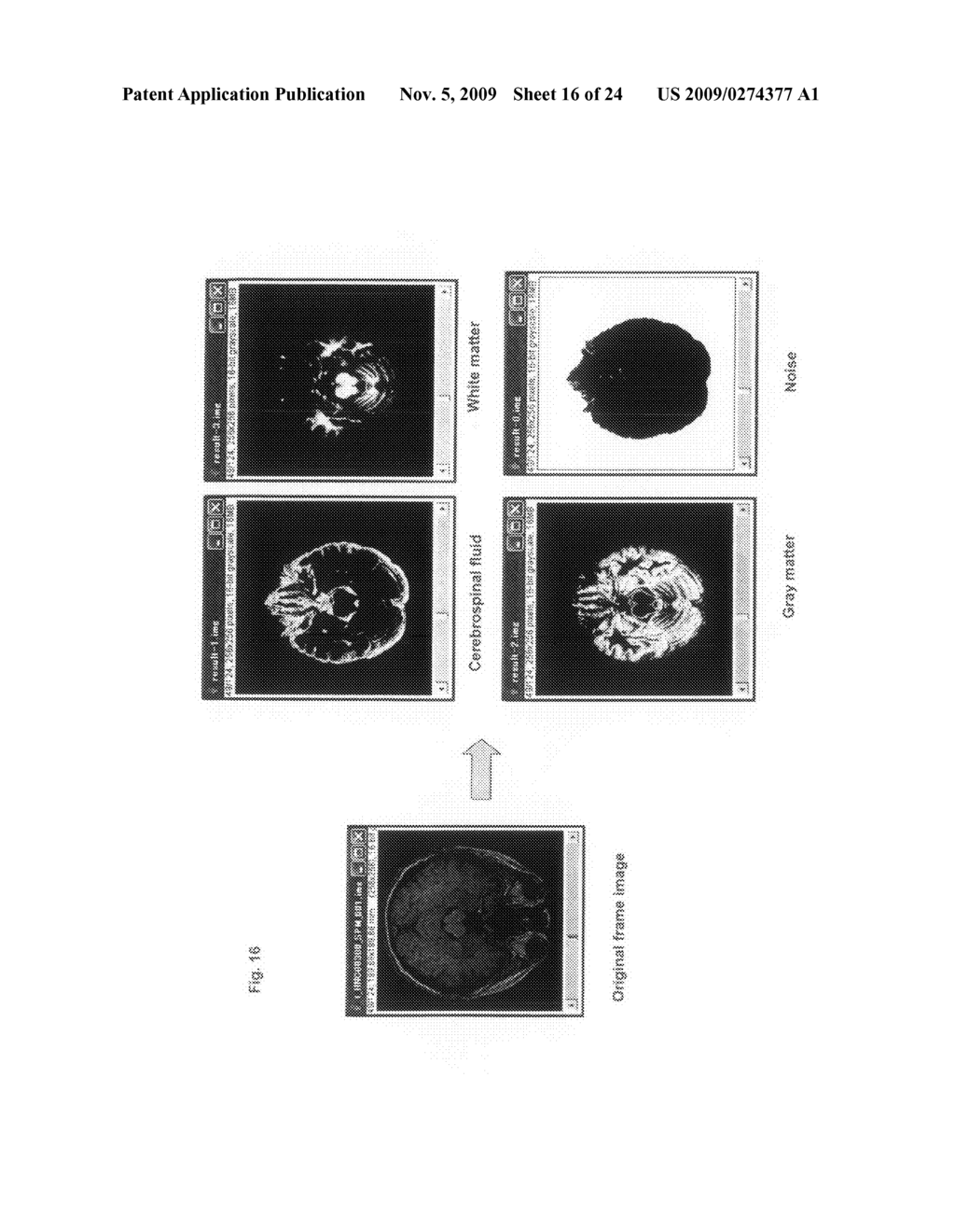 Clustering System and Image Processing System Having the Same - diagram, schematic, and image 17