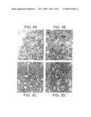 Human IgM antibodies, and diagnostic and therapeutic uses thereof particularly in the central nervous system diagram and image